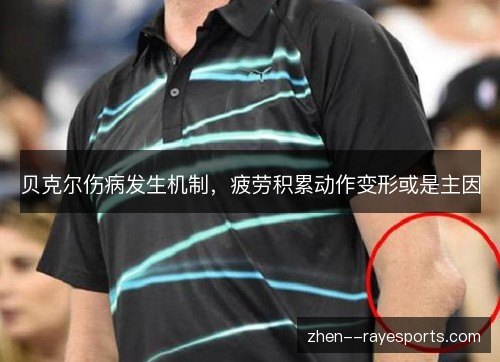 贝克尔伤病发生机制，疲劳积累动作变形或是主因